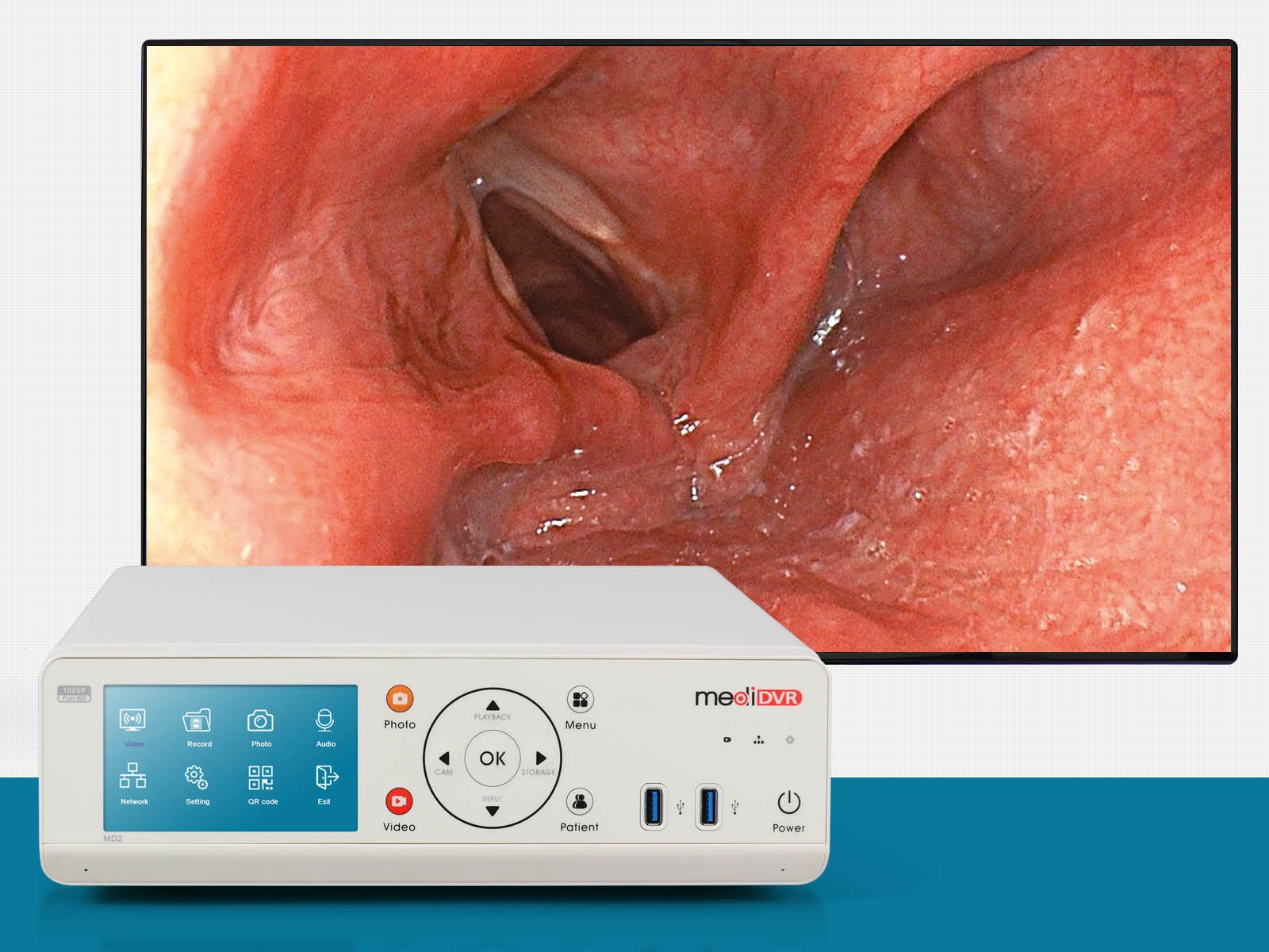 zowietek-surgical-video-recorder